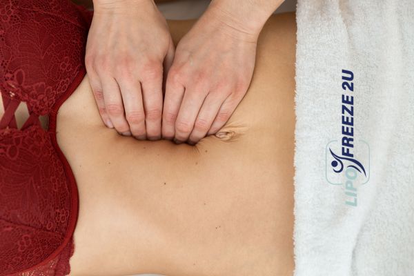 diastasis recti treatment Colchester