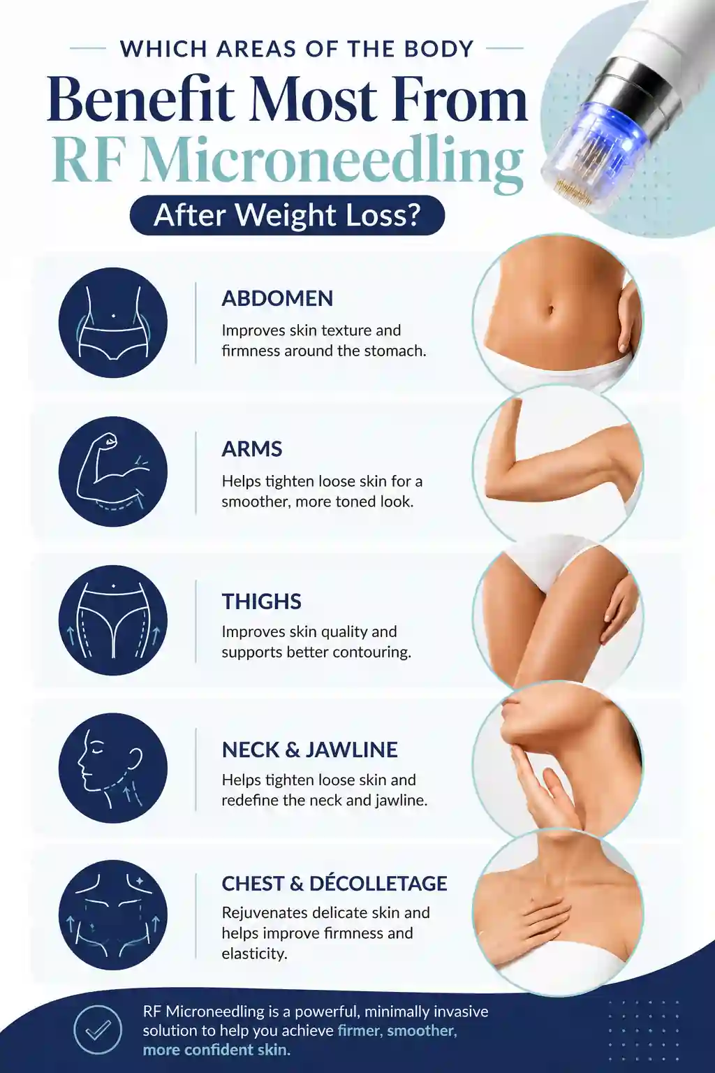 Which Areas of the Body Benefit Most From RF Microneedling After Weight Loss Colchester